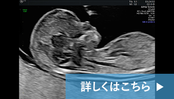 東京の産科・婦人科・出生前検査 新宿南口レディースクリニックの出生前検査では妊娠中に赤ちゃんの病気が分かった場合、生まれてからの治療やサポートを事前に準備することができます